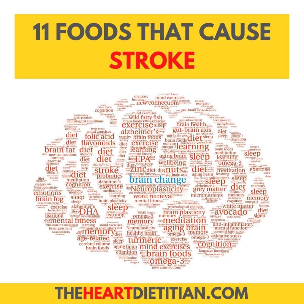 An image of a word cloud in the shape of a brain, containing words like "exercise, diet, and memory". The title of the image reads "11 Foods That Cause Stroke".